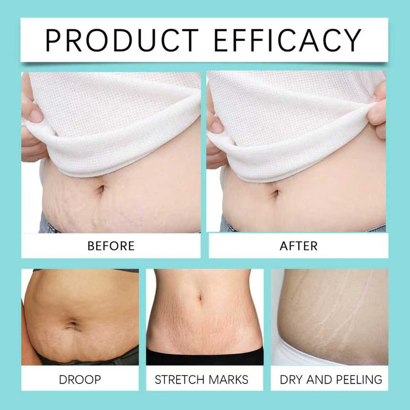 Collagen Stretch Mark Removal Oil