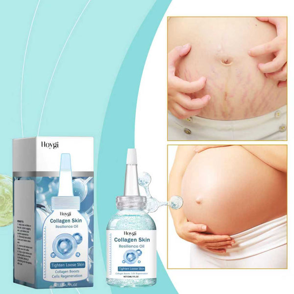 Collagen Stretch Mark Removal Oil